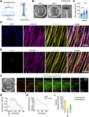 A 3D cell culture system for bioengineering human neuromuscular junctions to model ALS